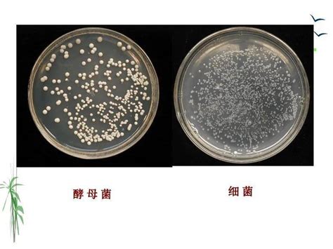 黴菌有哪些|霉菌（分枝菌丝的真菌的统称）